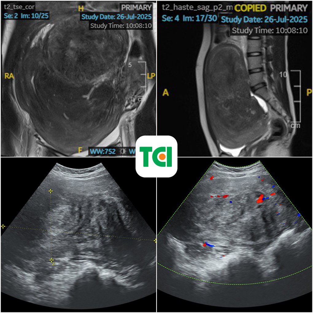 Tin tức 1