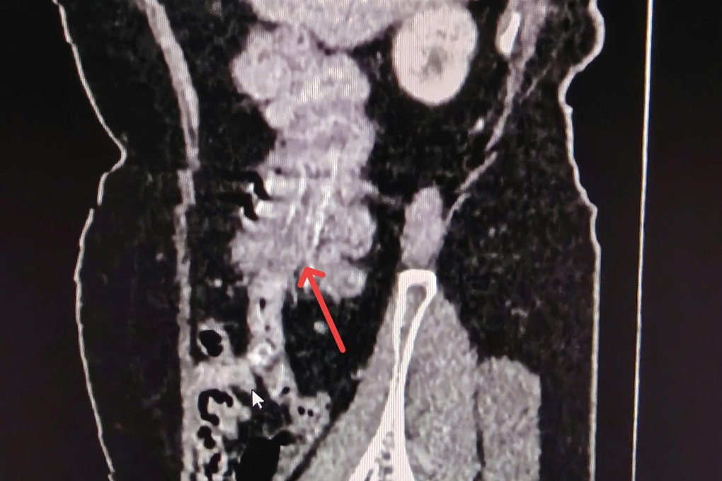 Tin tức 1